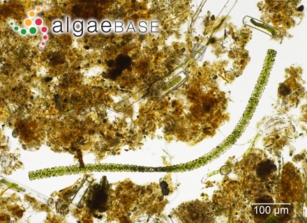 Sphaerozosma vertebratum Brébisson ex Ralfs