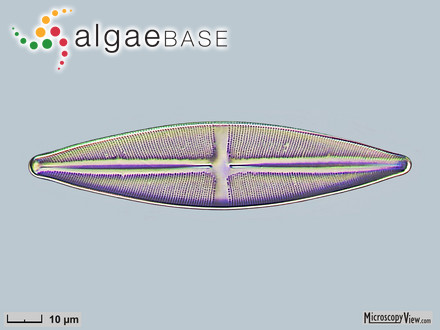 Stauroneis phoenicenteron (Nitzsch) Ehrenberg