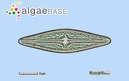 Brachysira vitrea (Grunow) R.Ross