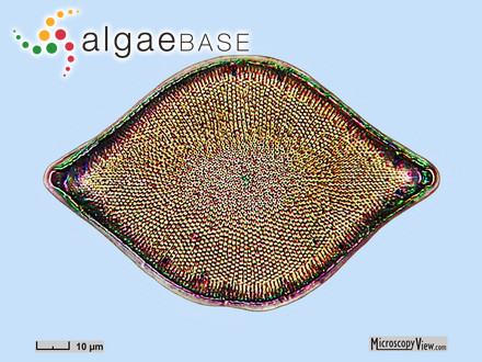 Zygoceros rhombus Ehrenberg