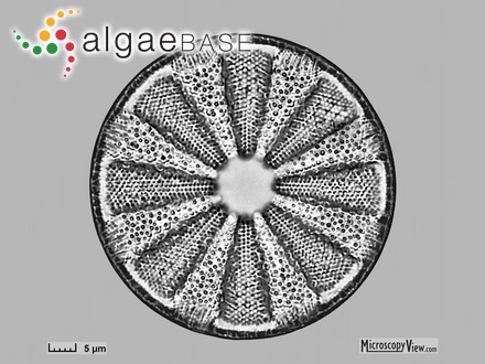 Actinoptychus vulgaris Schumann