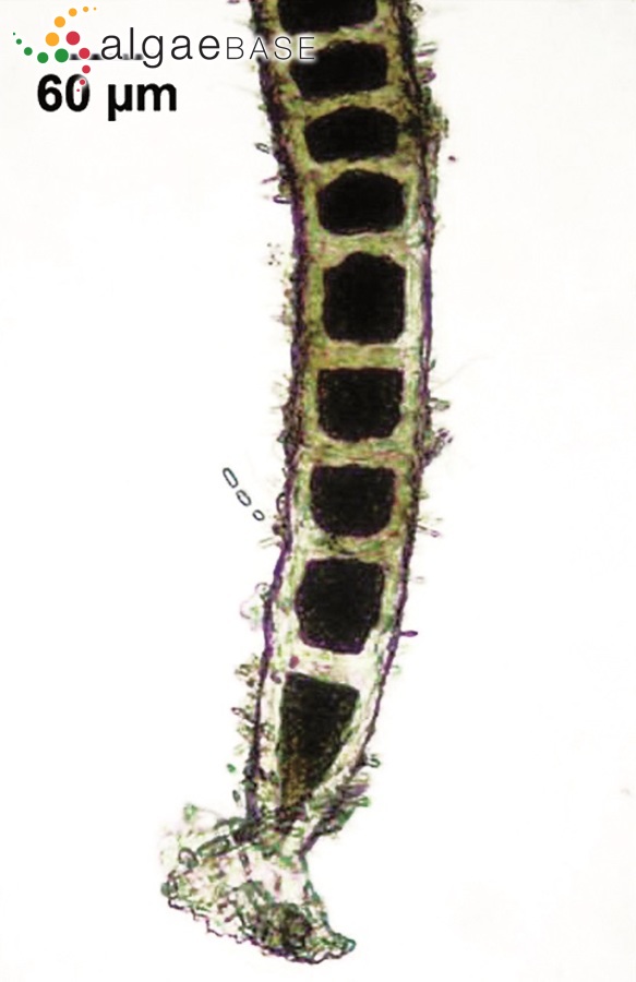 Chaetomorpha linum (O.F.Müller) Kützing
