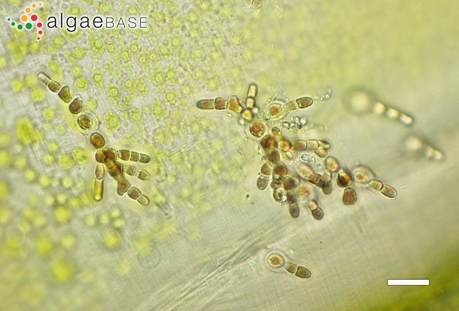 Acrochaetium microscopicum (Nägeli ex Kützing) Nägeli