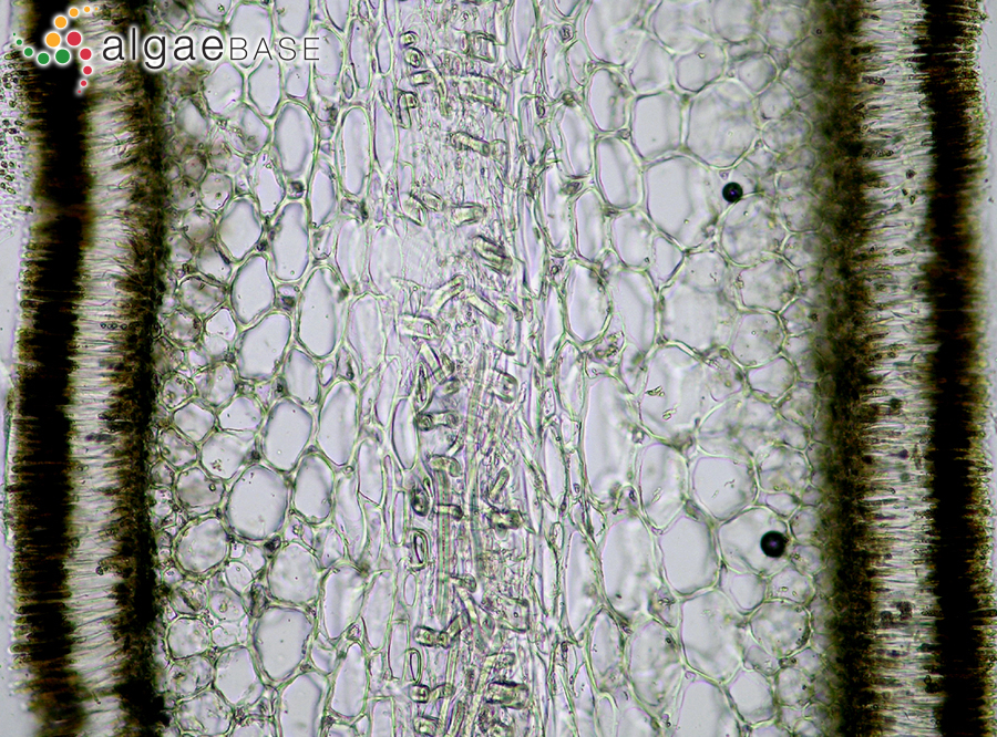 Saccorhiza polyschides (Lightfoot) Batters