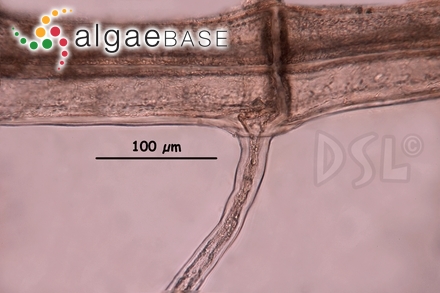 Melanothamnus tongatensis (Harvey ex Kützing) Díaz-Tapia & Maggs