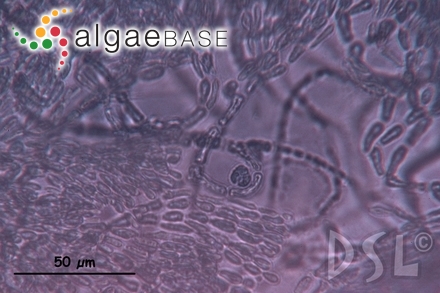 Platoma fanii E.Y.Dawson