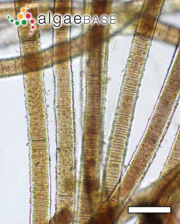 lyngbya under microscope