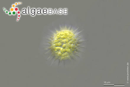 Glochiococcus aciculiferus (Lagerheim) P.C.Silva