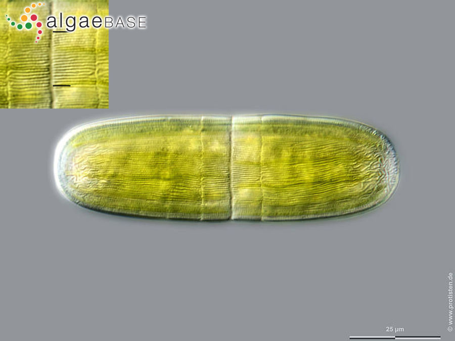Penium polymorphum (Perty) Perty