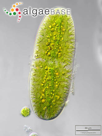 Netrium digitus var. lamellosum (Brébisson ex Kützing) Grönblad