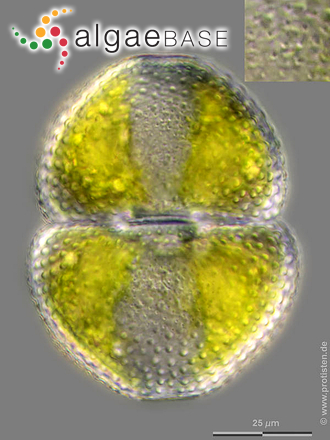Cosmarium botrytis Meneghini ex Ralfs