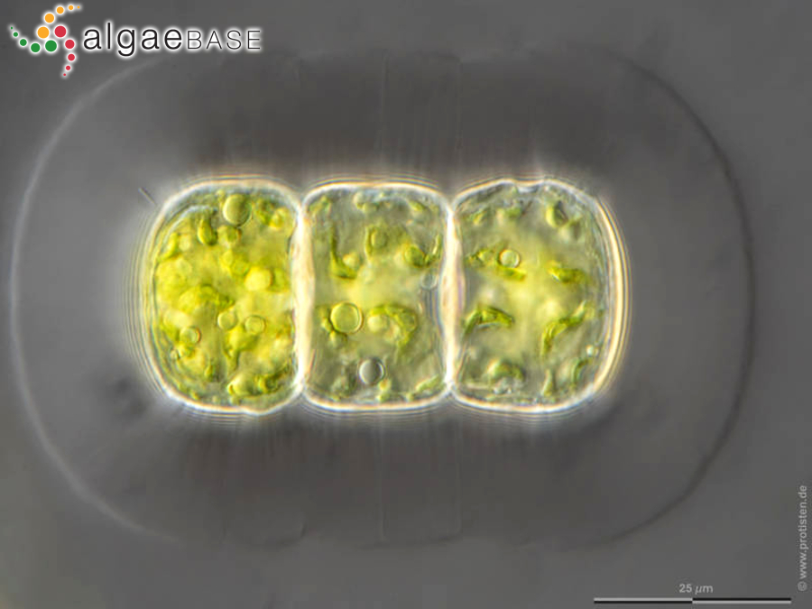 Hyalotheca dissiliens Brébisson ex Ralfs