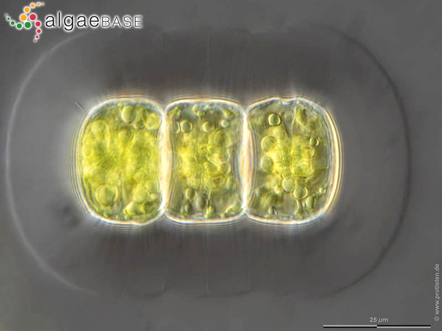 Hyalotheca dissiliens Brébisson ex Ralfs