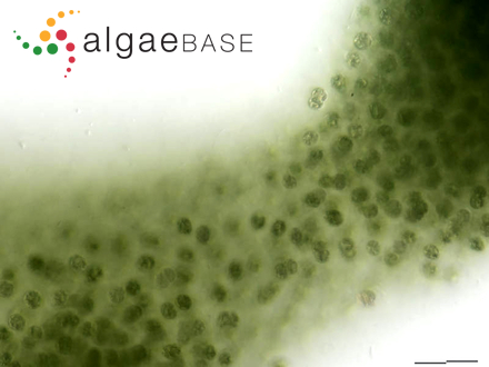 Microcystis aeruginosa (Kützing) Kützing