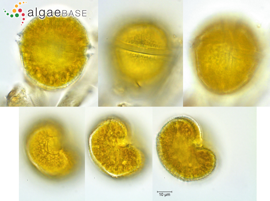Gymnodinium uberrimum (G.J.Allman) Kofoid & Swezy
