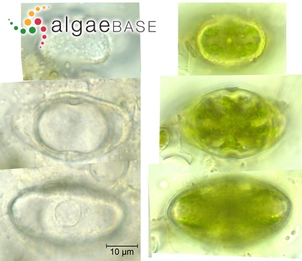 Cosmarium nymannianum Grunow