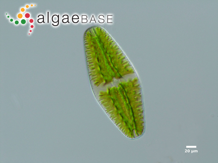 Netrium digitus (Brébisson ex Ralfs) Itzigsohn & Rothe