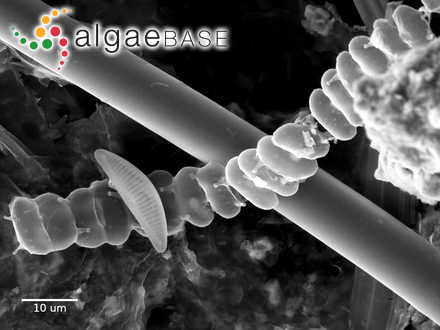 Sphaerozosma filiforme Ralfs