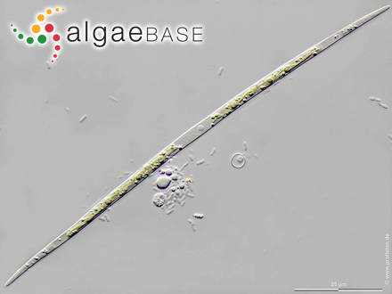 Closterium acutum var. linea (Perty) West & G.S.West