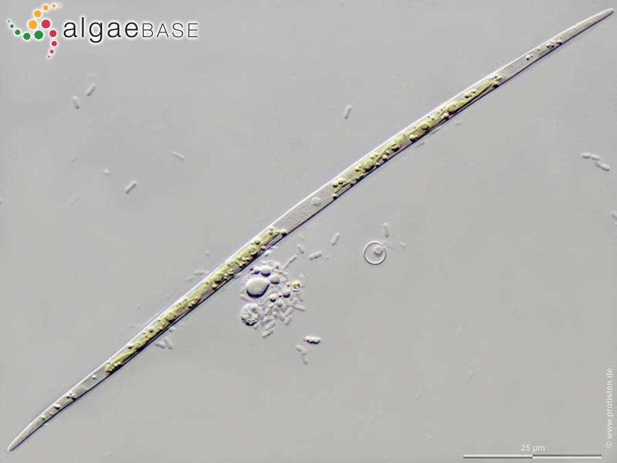 Closterium acutum var. linea (Perty) West & G.S.West