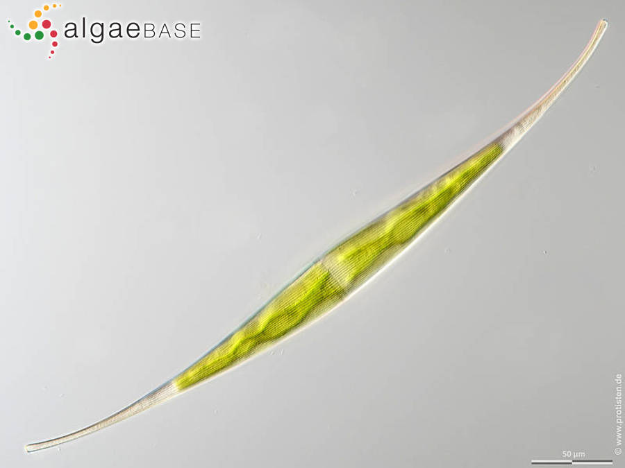 Closterium rostratum Ehrenberg ex Ralfs