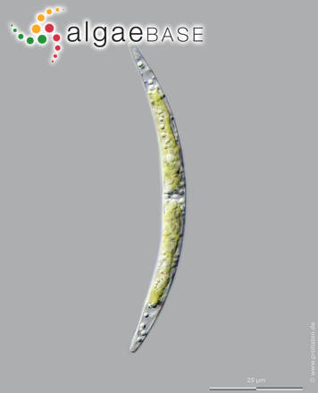 Closterium parvulum var. angustum West & G.S.West