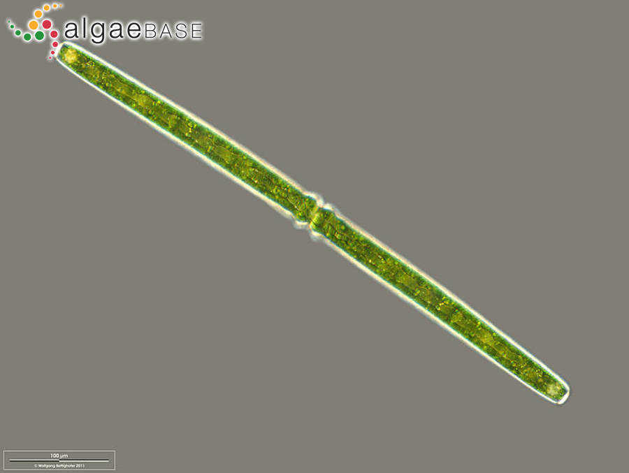 Pleurotaenium trabecula var. elongatum Cedergren