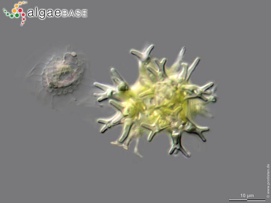 Pseudostaurastrum enorme (Ralfs) Chodat
