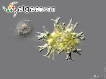 Pseudostaurastrum enorme (Ralfs) Chodat