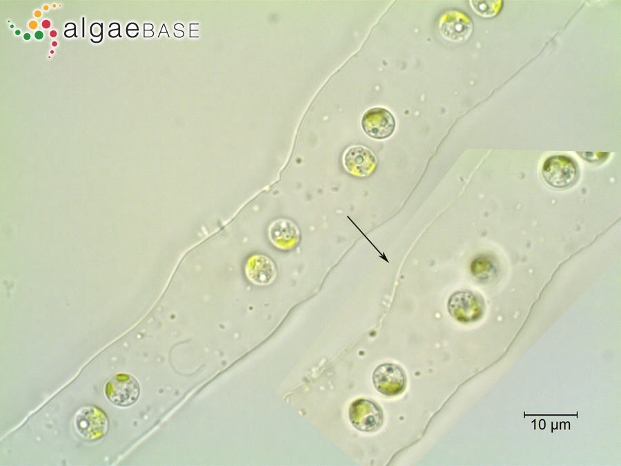 Palmodictyon varium (Nägeli) Lemmermann