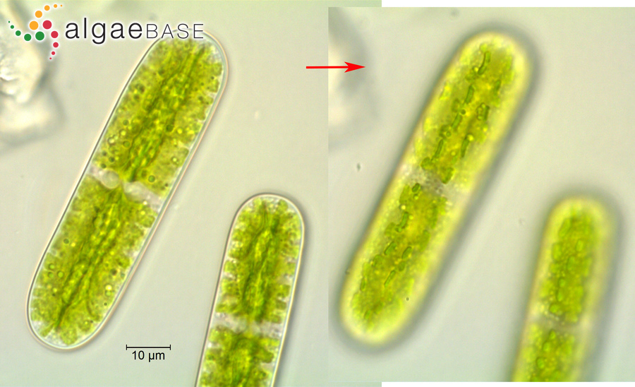 Netrium cylindricum (West & G.S.West) Coesel & Meesters