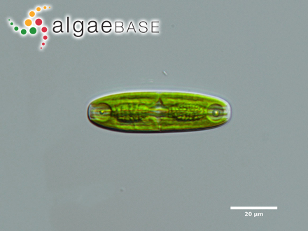 Planotaenium ohtanii A.A.Gontcharov & Melkonian