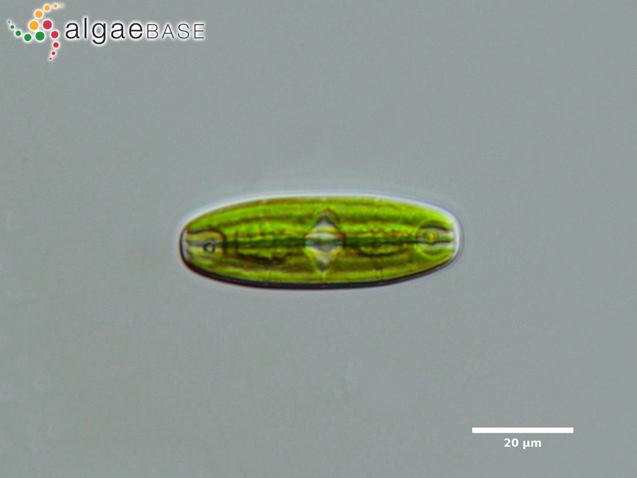 Planotaenium ohtanii A.A.Gontcharov & Melkonian