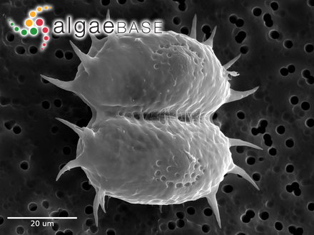 Xanthidium antilopaeum var. depauperatum West & G.S West :: AlgaeBase