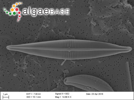 Gomphonema globiferum Meister