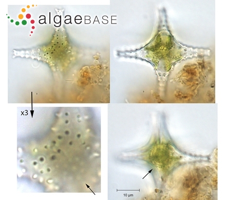 Psammothidium kuelbsii (Lange-Bertalot) Bukhtiyarova & Round