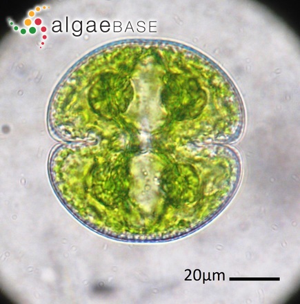 Cosmarium tutum Shyndanovina