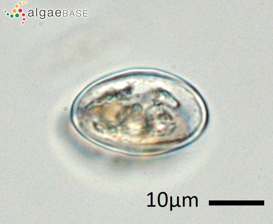 Cosmarium angulare L.N.Johnson