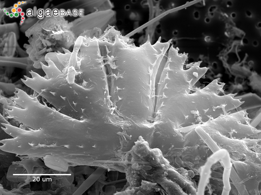 Micrasterias papillifera Brébisson ex Ralfs