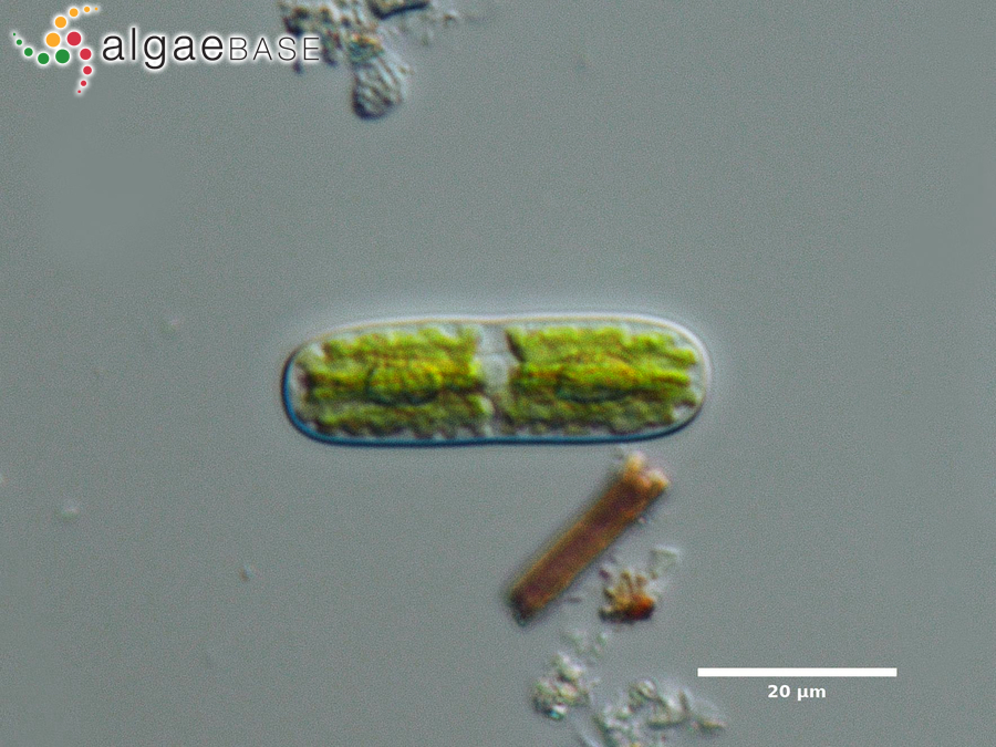 Cylindrocystis brebissonii (Ralfs) De Bary