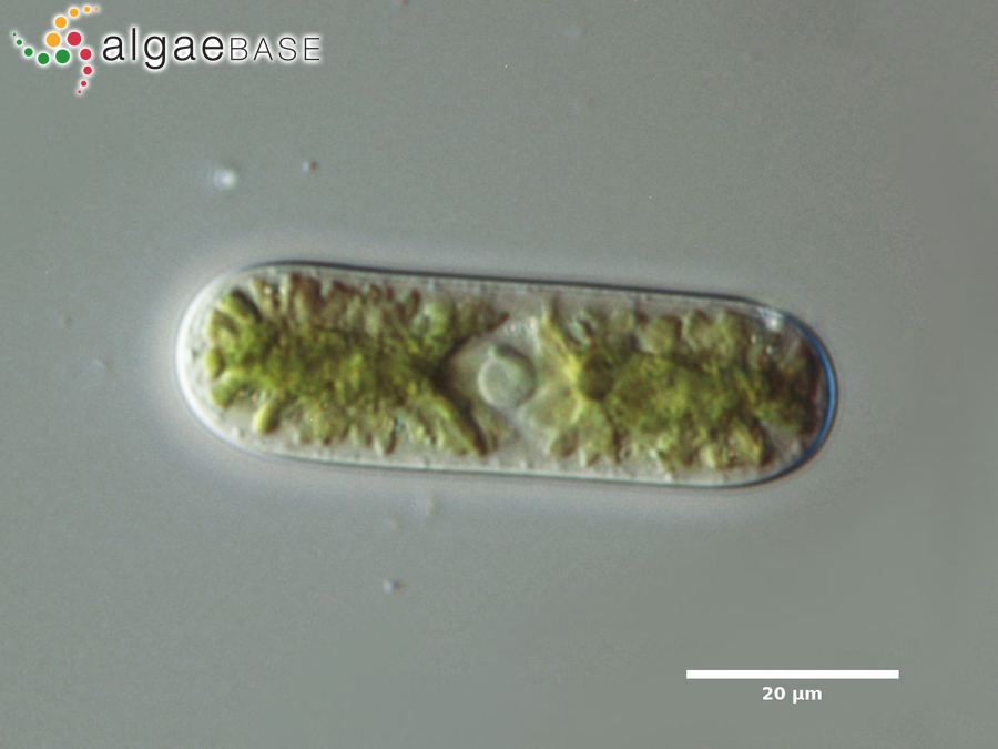 Cylindrocystis brebissonii (Ralfs) De Bary