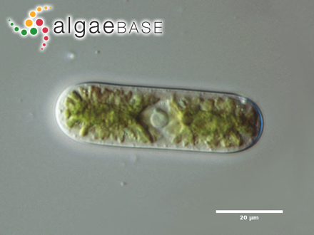 Cylindrocystis brebissonii (Ralfs) De Bary