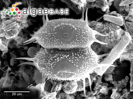 Xanthidium polymazum (Nordstedt) Coesel & Meesters :: AlgaeBase