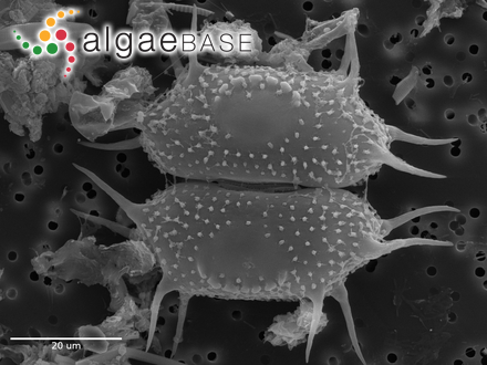 Xanthidium polymazum (Nordstedt) Coesel & Meesters