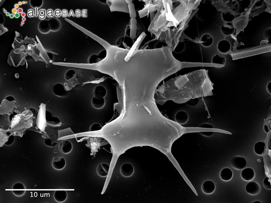 Staurodesmus octocornis (Ehrenberg ex Ralfs) Stastny, Skaloud & Neustupa