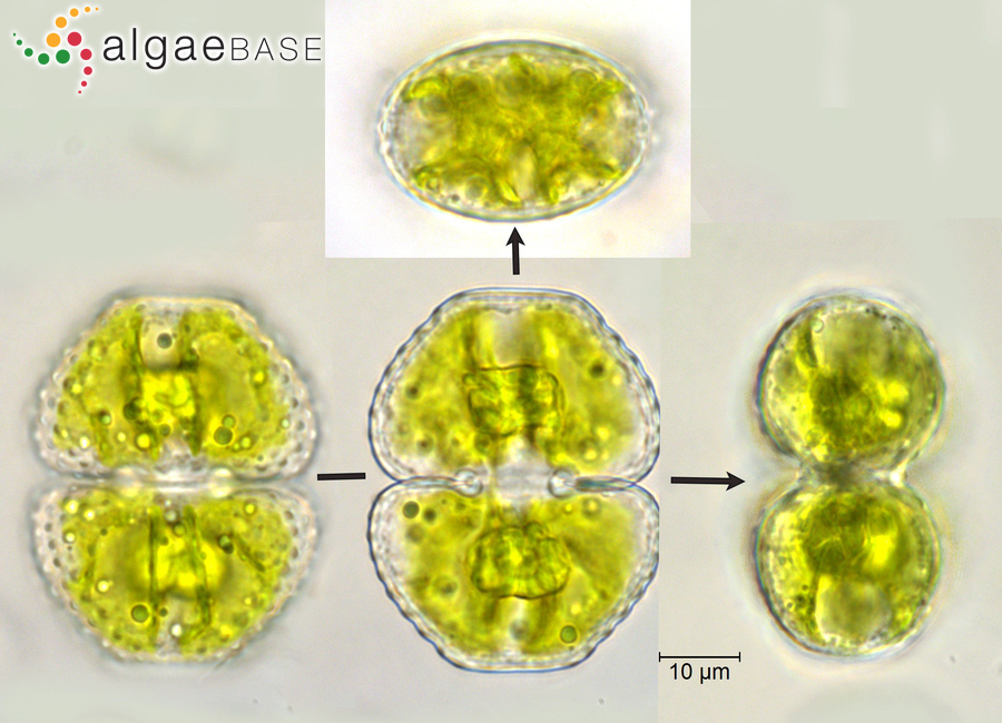 Cosmarium vexatum var. lacustre Messikommer