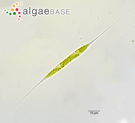 Schroederia setigera (Schröder) Lemmermann