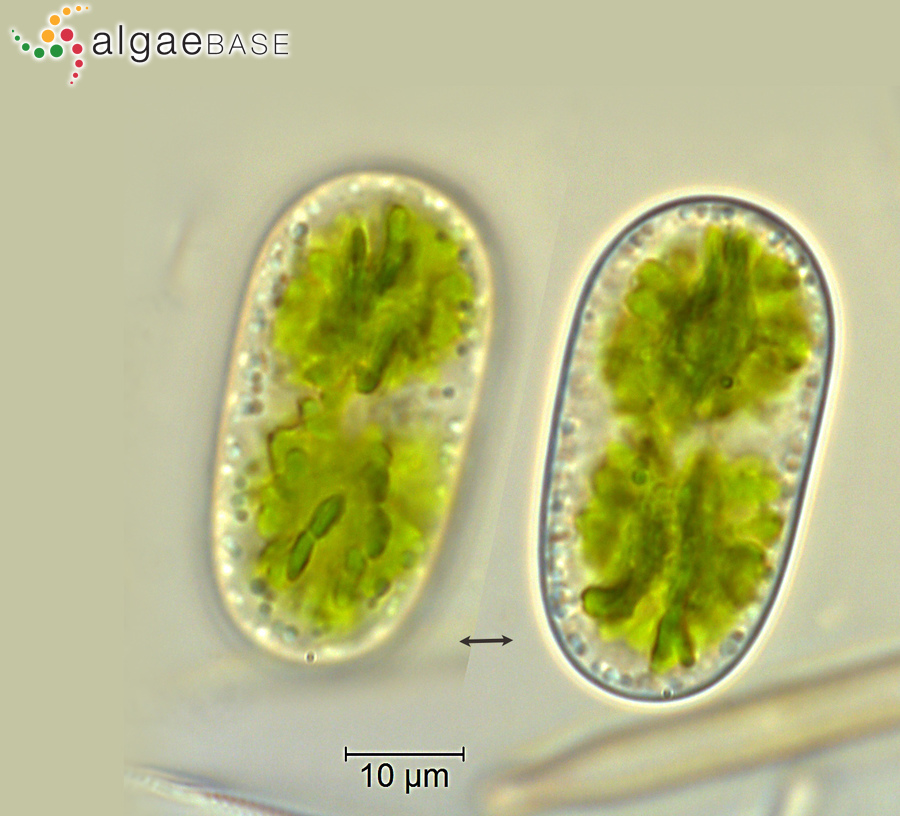 Cylindrocystis brebissonii (Ralfs) De Bary