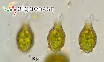 Strombomonas acuminata (Schmarda) Deflandre